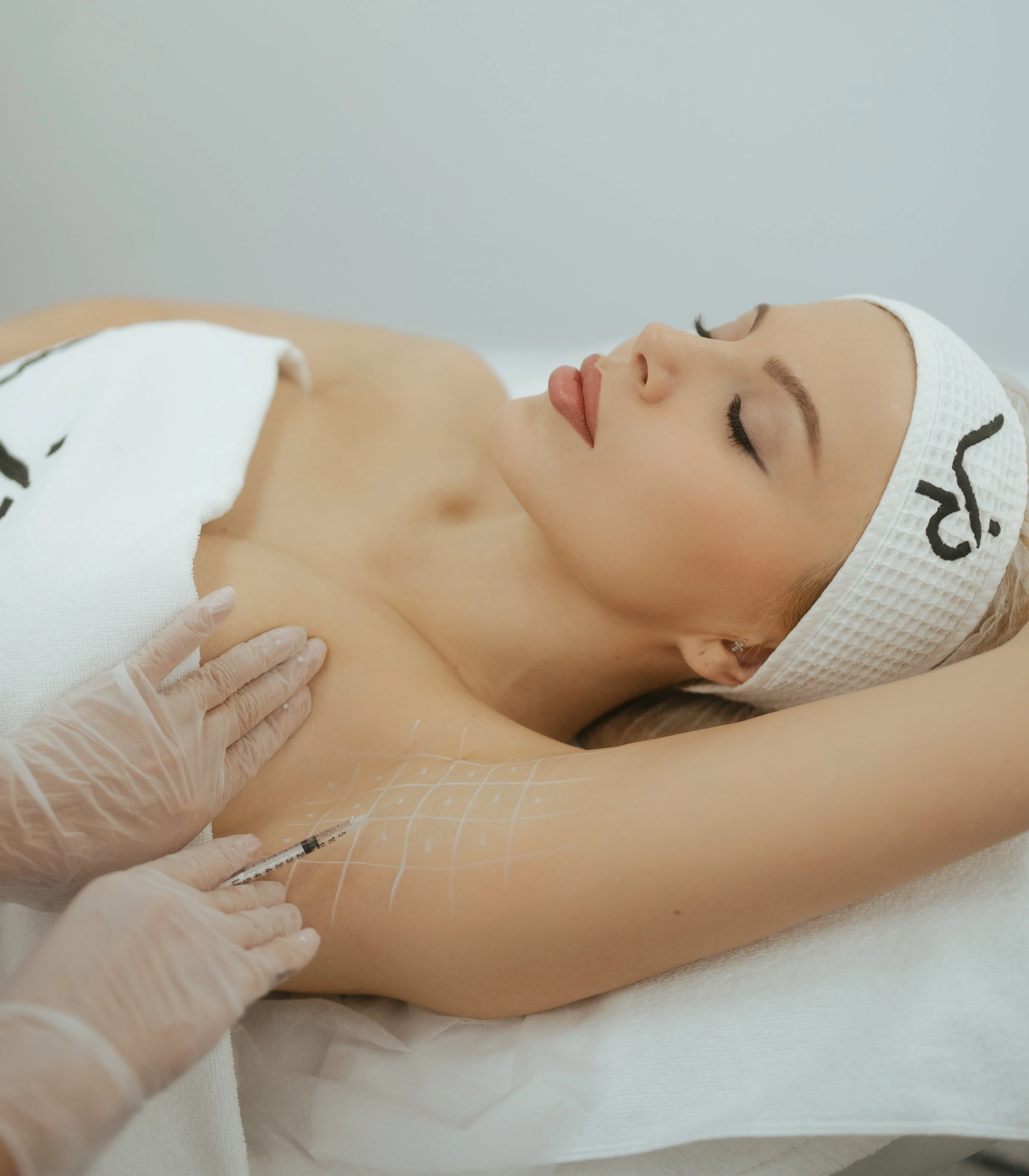 Лечение гипергидроза