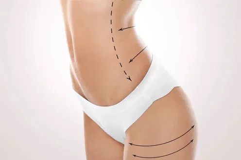 Как восстановить фигуру после родов?