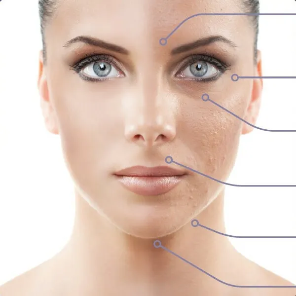 Что такое карбокситерапия в косметологии?