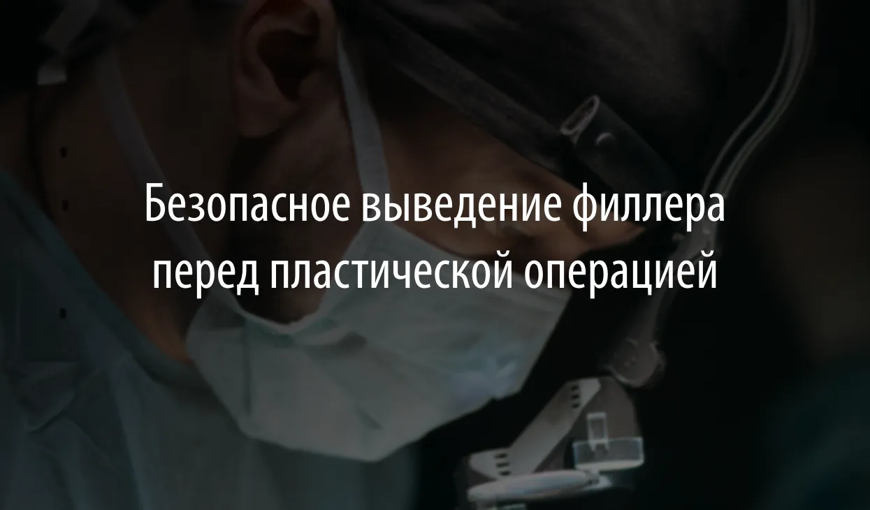 Безопасное выведение филлера перед пластической операцией