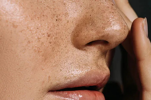 Способы выравнивания носа