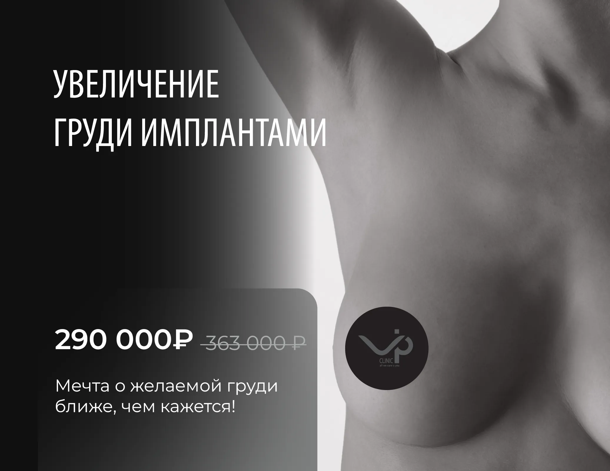 Маммопластика: увеличение груди за 290 000 р.