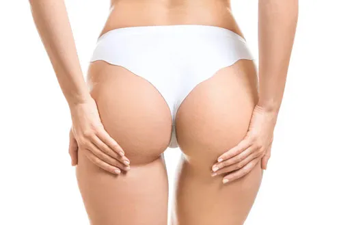 Липофилинг интимной зоны