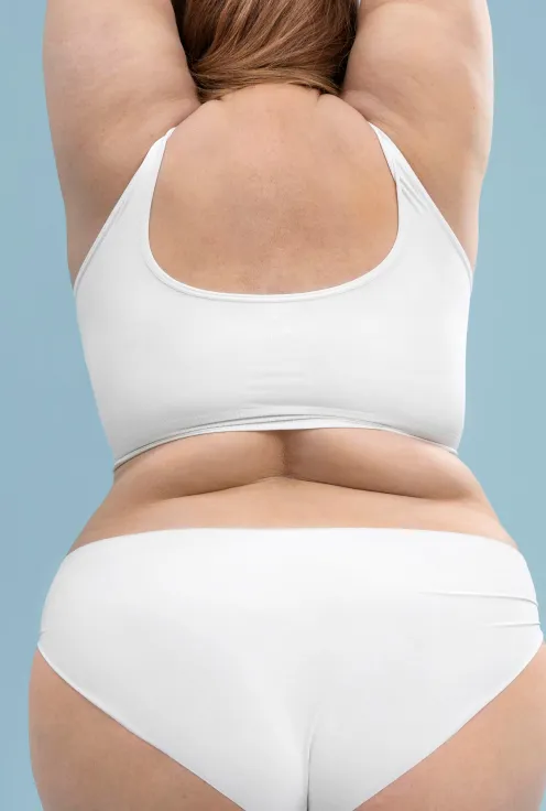 Липосакция спины