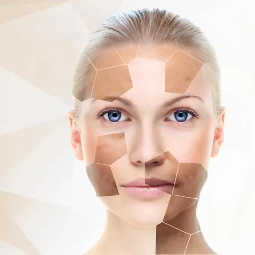 Проект "Скажи пигментации НЕТ"