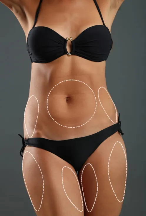 Липомоделирование тела