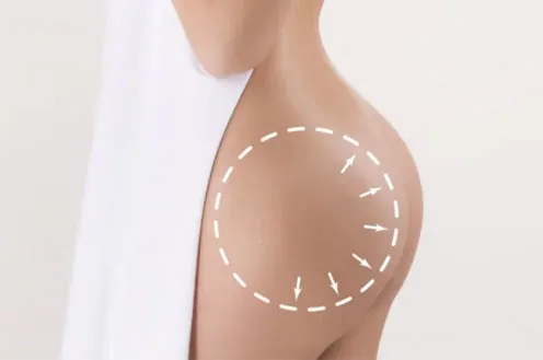 Как увеличить попу?