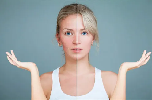 Проект "Скажи пигментации НЕТ"