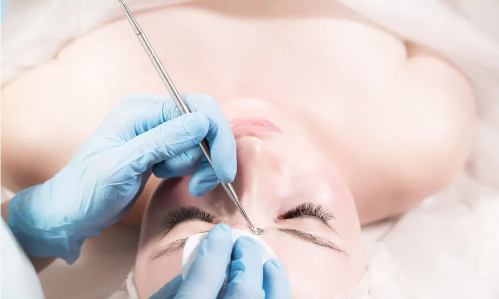 механическая чистка