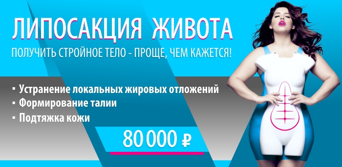 Липосакция живота vipclinic39 Липосакция живота
