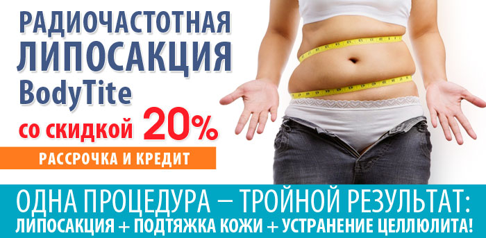 Липосакция BodyTite (ЗАВЕРШЕНА) vipclinic39 Липосакция BodyTite (ЗАВЕРШЕНА)