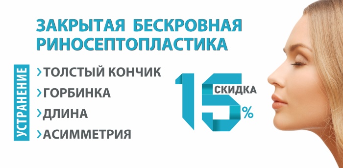 Риносептопластика со скидкой 15% vipclinic39 Риносептопластика со скидкой 15%