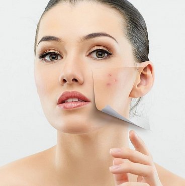 Как избавиться от шрамов и восстановить кожу?